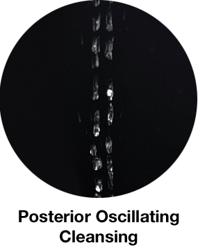 posterior ossilating